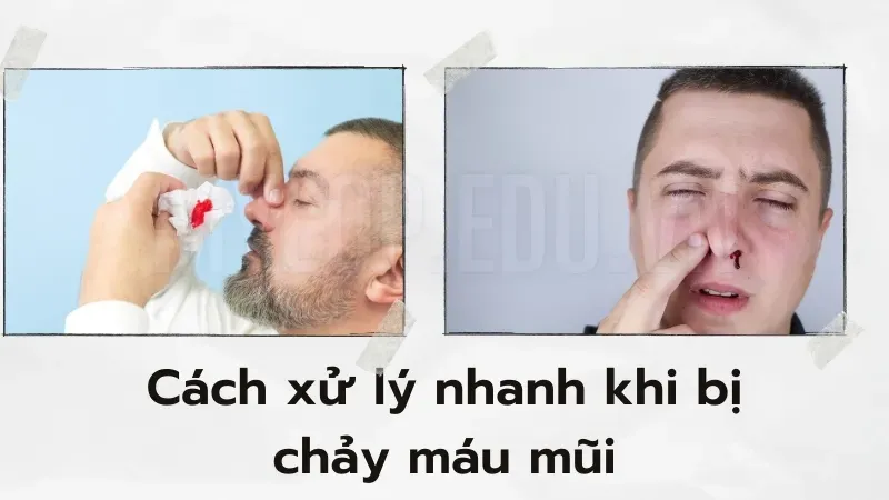 Chảy máu mũi đột ngột - Cách cầm máu nhanh chóng và hiệu quả tại nhà 3