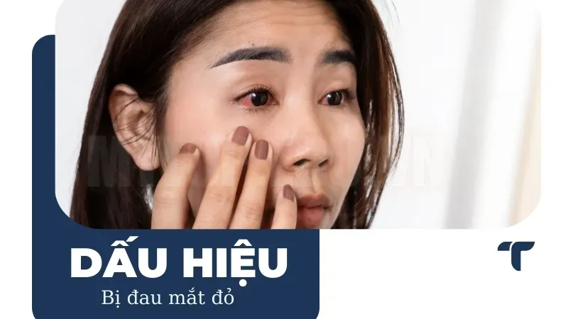 Đau mắt đỏ phải làm gì để dịu đôi mắt và nhanh chóng khỏi bệnh 7