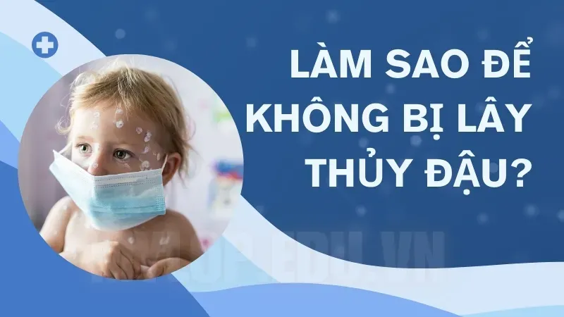 Cách phòng tránh thủy đậu đúng cách - Bị thủy đậu rồi có bị lại không? 4