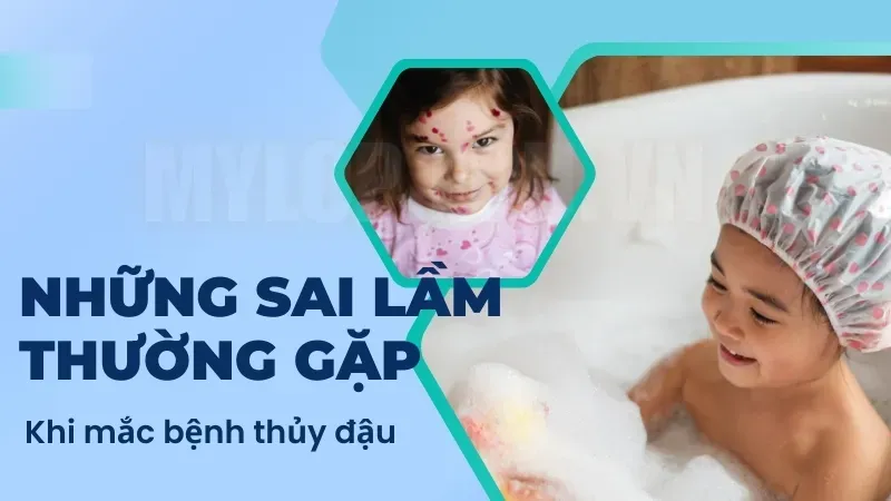 Cách phòng tránh thủy đậu đúng cách - Bị thủy đậu rồi có bị lại không? 6