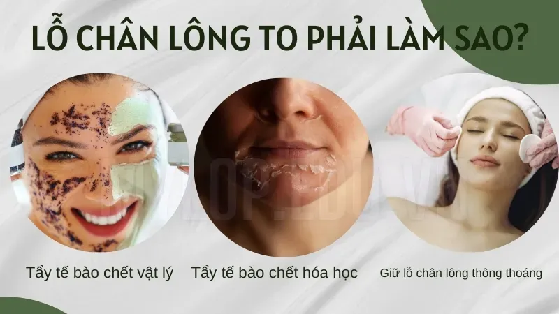 Lỗ chân lông to nên làm gì? Các bước skincare hiệu quả dành cho bạn 5