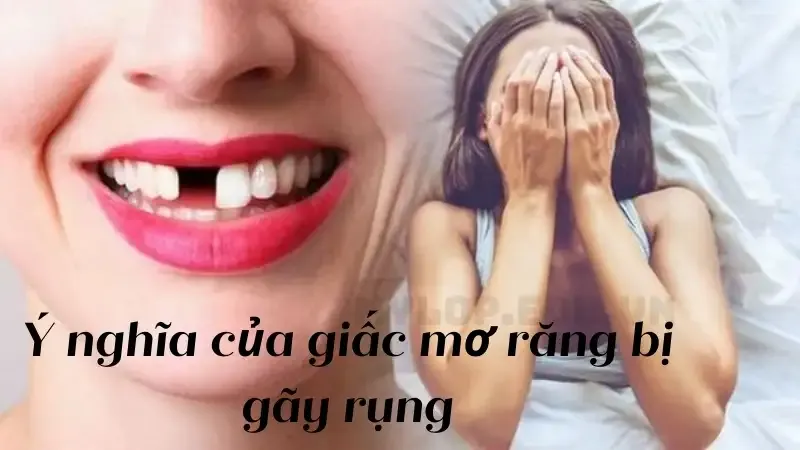 Ý nghĩa của giấc mơ răng bị gãy rụng