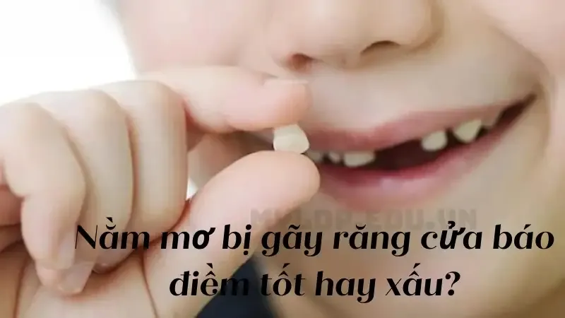 nằm mơ gãy răng cửa là điềm gì 1