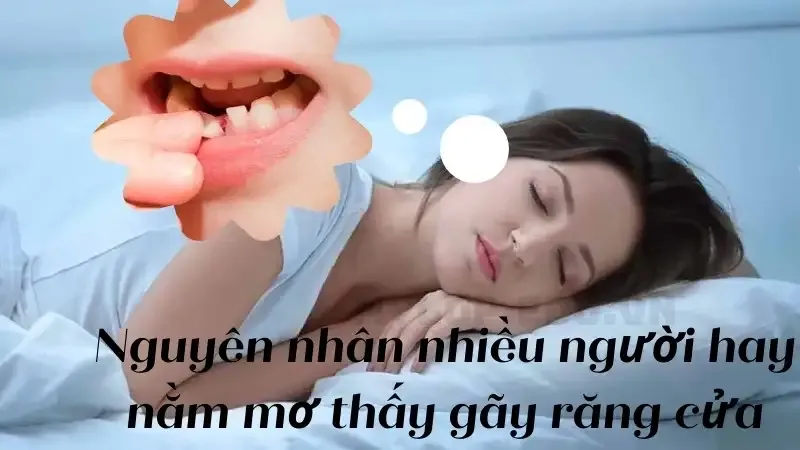 Nguyên nhân nhiều người hay nằm mơ thấy gãy răng cửa