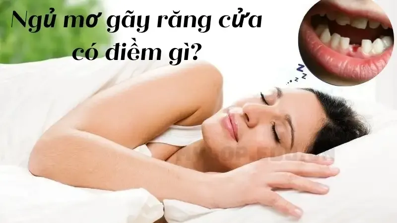 Ngủ mơ gãy răng cửa có điềm gì?