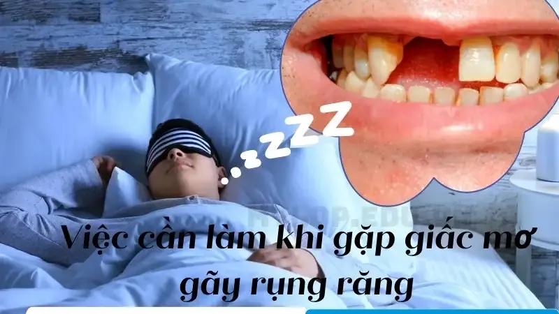 Việc cần làm khi gặp giấc mơ gãy rụng răng