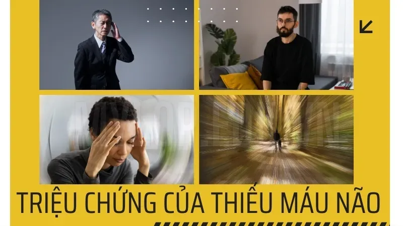 Thiếu máu não nên làm gì để ngăn ngừa biến chứng đột quỵ? 5