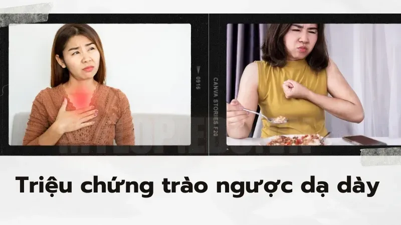 Trào ngược dạ dày nên làm gì để giảm triệu chứng ngay lập tức? 6