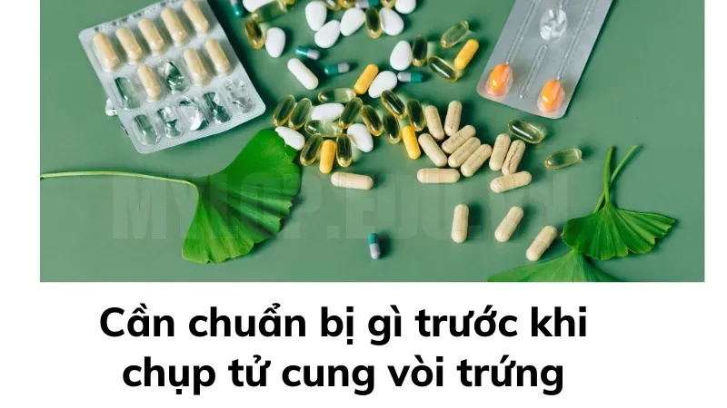 Lưu ý trước khi chụp tử cung vòi trứng để giảm đau và khó chịu 1