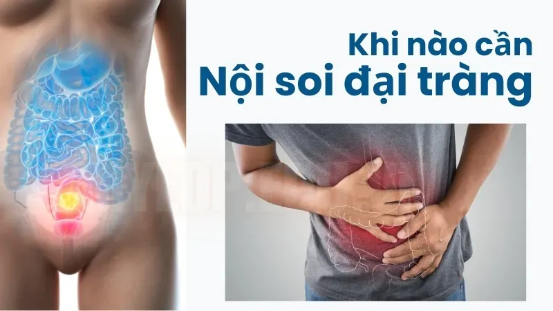 Trước khi nội soi đại tràng có được ăn không? Những lưu ý cần biết 7