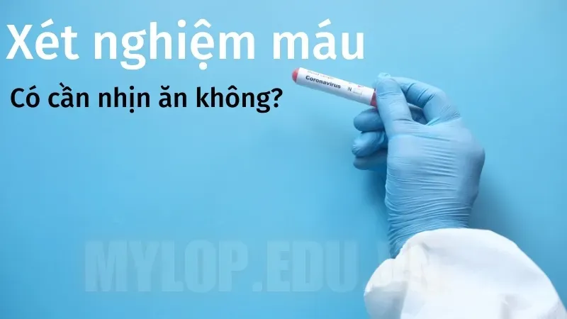 Cần làm gì trước khi xét nghiệm máu để kết quả chính xác nhất? 4