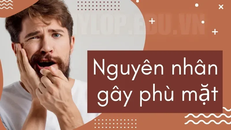 Uống thuốc bị sưng vù mặt phải làm sao? Chuyên gia giải đáp 5