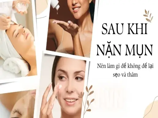 Sau khi lấy nhân mụn nên làm gì để không bị sẹo thâm?