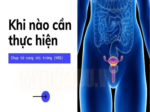 Lưu ý trước khi chụp tử cung vòi trứng để giảm đau và khó chịu