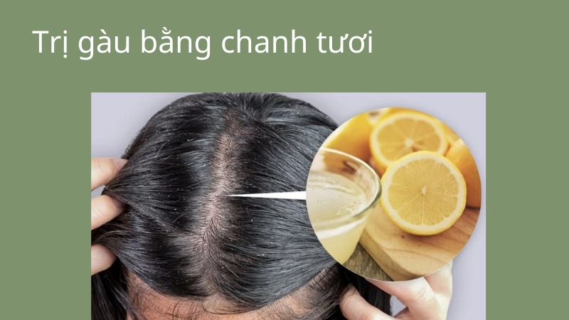 Đừng bỏ lỡ cách trị gàu tận gốc bằng chanh tươi