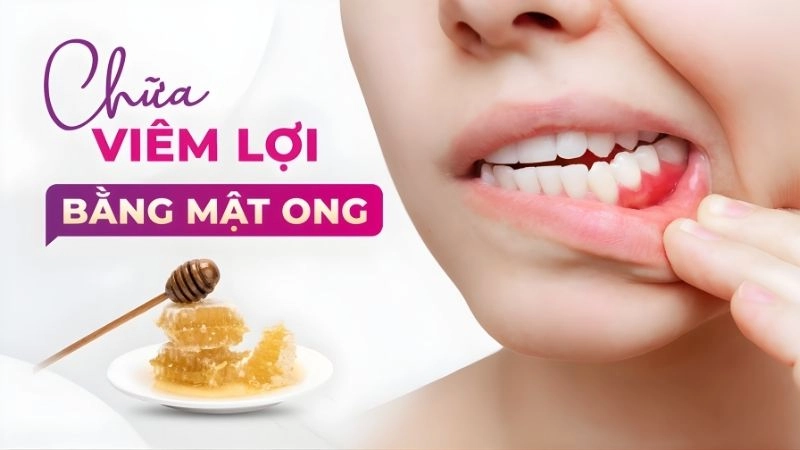 Kháng viêm mạnh mẽ với tinh chất mật ong nguyên chất
