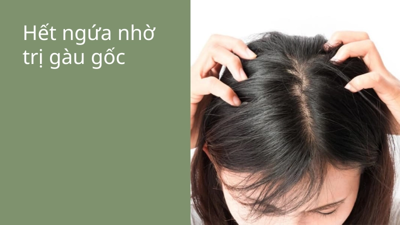 Dứt điểm ngứa nhờ cách trị gàu tận gốc an toàn