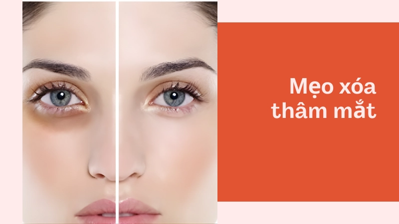 Những mẹo trị thâm mắt tự nhiên