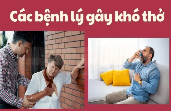 Bị khó thở đột ngột - 5 Cách xử lý tại nhà hiệu quả nhất