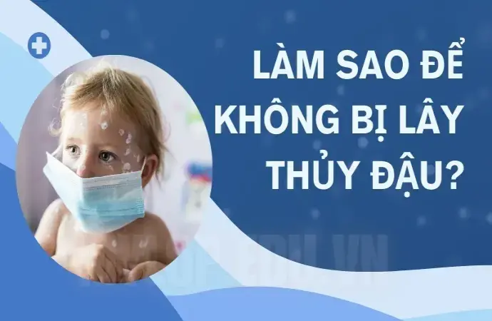 Cách phòng tránh thủy đậu đúng cách - Bị thủy đậu rồi có bị lại không?