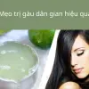 Bí kíp review cách trị gàu tận gốc hiệu quả sau 7 ngày ngay