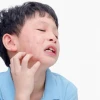 Bí quyết chữa quai bị bằng mẹo dân gian hiệu quả và an toàn