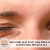 Giải mã hiện tượng nháy mắt phải: Điềm báo hên hay xui, có phải dấu hiệu bệnh lý?