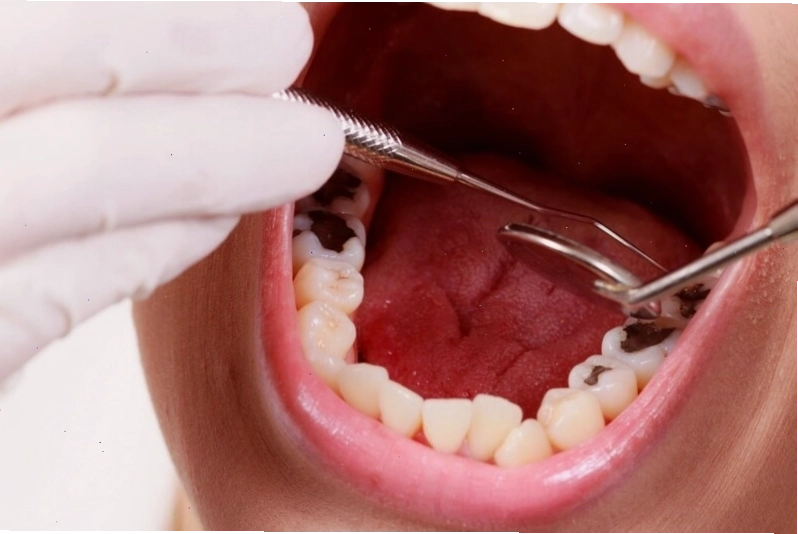 Cần đi khám nha sĩ để tìm nguyên nhân và điều trị nhức răng