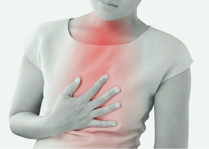 Hình ảnh minh họa tình trạng trào ngược dạ dày thực quản gây khó chịu