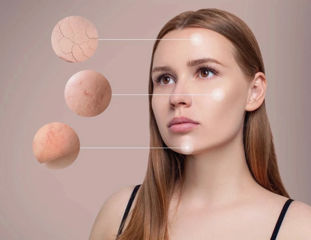 Massage bụng sau sinh với dầu dừa giúp làm mờ rạn da