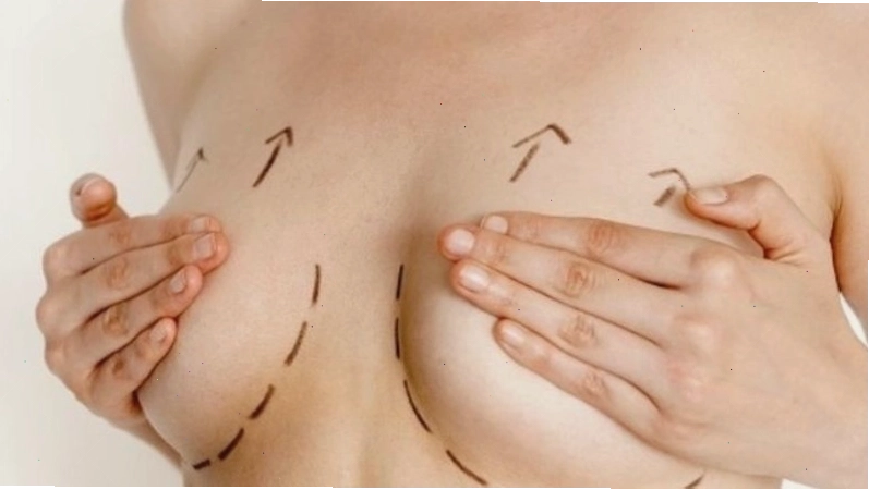 Massage ngực để thông tia sữa