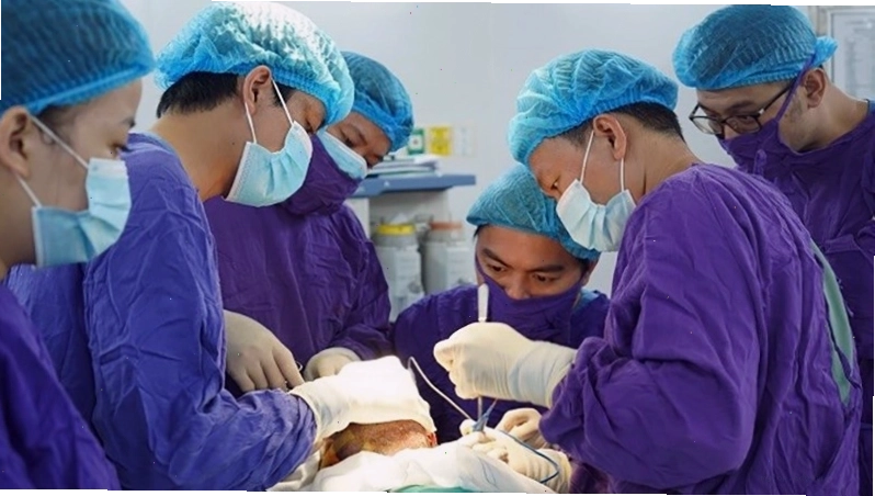 Phẫu thuật cắt bỏ tuyến nước bọt khi tình trạng chảy nước dãi nặng
