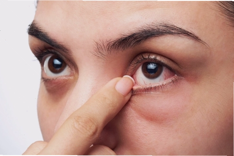 Sử dụng nước muối sinh lý để rửa mắt khi có bụi