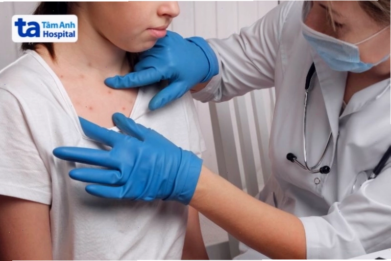 Tái khám định kỳ sau điều trị sốt rét