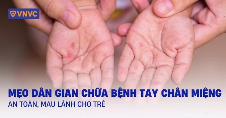 Tóm tắt các biện pháp chăm sóc và điều trị bệnh tay chân miệng