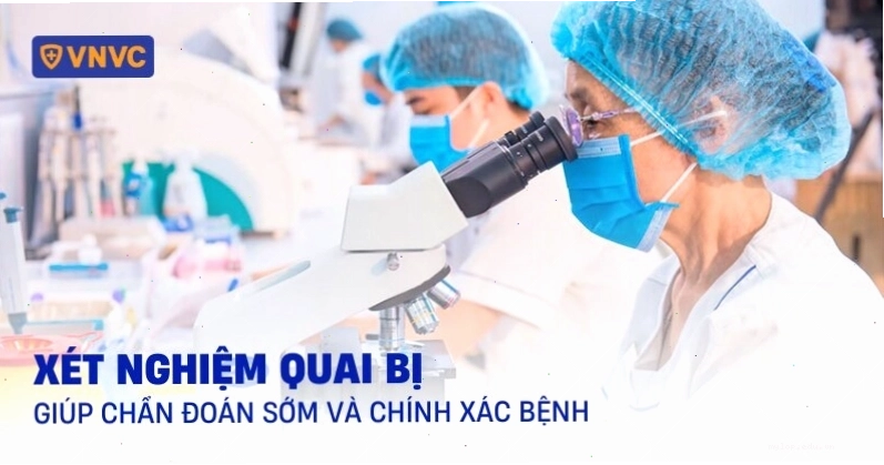 Xét nghiệm chẩn đoán quai bị