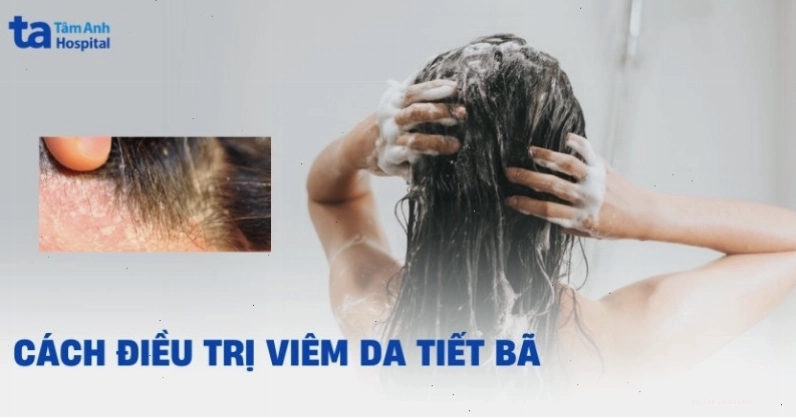 Các bước chuẩn bị trước khi điều trị viêm da tiết bã cho chó