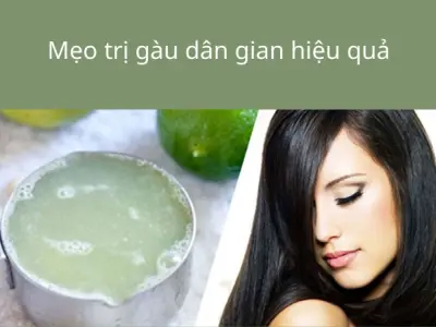 Bí kíp review cách trị gàu tận gốc hiệu quả sau 7 ngày ngay