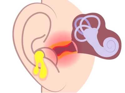 Bí quyết trị viêm tai giữa ở người lớn hiệu quả và an toàn